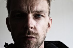 20代が毛穴の白い角栓を減らす方法とは？