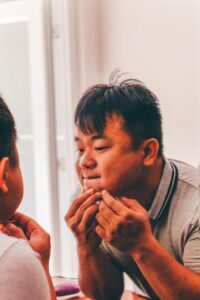 脱毛後にニキビを防止するためのルーティンは？